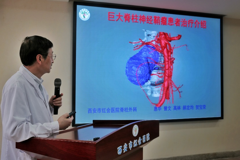 西安市红会医院治疗一例复杂胸椎肿瘤
